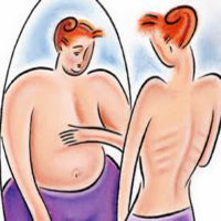 Anorexia Nervoasa